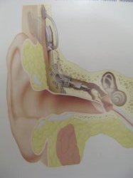 Schematic illustration of an implantable hearing device