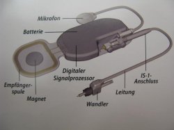 Hearing device components